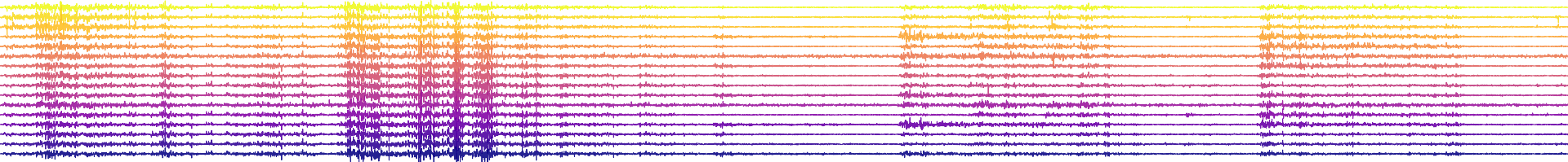 EMG Traces