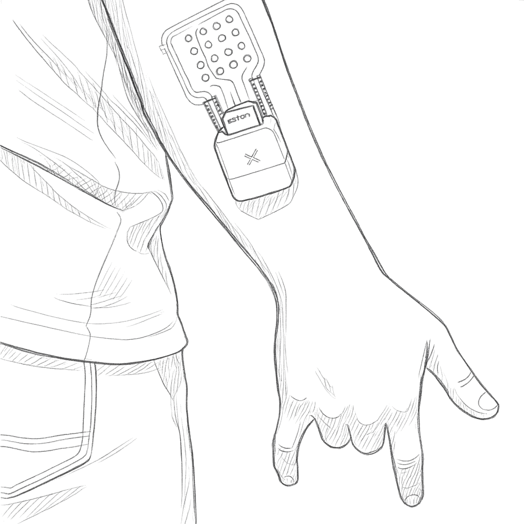 Static Condition 1: Hand held down straight